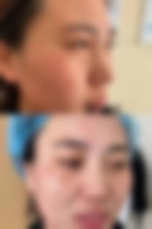 四、甘肃酒泉华美医疗美容医院特色项目