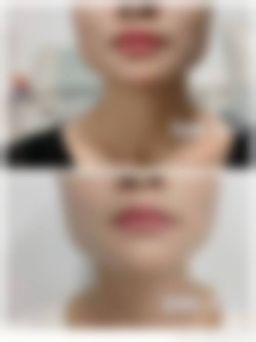 三、秦皇岛巧致整形美容医院诊疗项目有哪些？