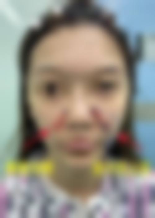 八、甘肃酒泉华美医疗美容医院预约方式