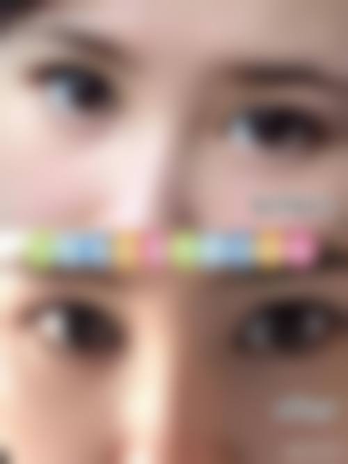 四、秦皇岛巧致整形美容医院特色项目