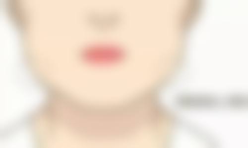 耳软骨隆鼻需要住院吗？了解手术情况及住院时长让你心中有数