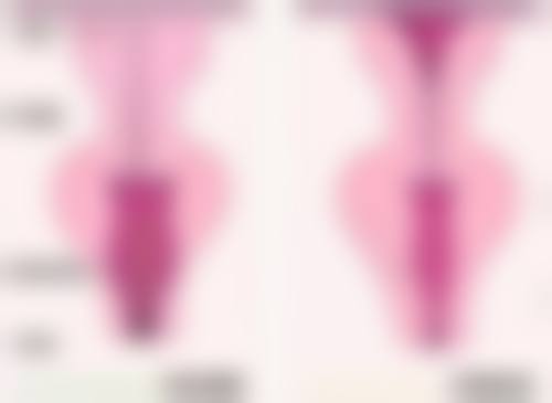 一、耳软骨隆鼻手术是怎么回事