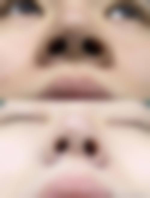 八、深圳星秀医疗美容门诊部真实的患者评价