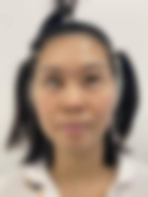 四、重庆贝芙丽整形医院特色项目