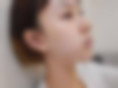 四、深圳星秀医疗美容门诊部特色项目