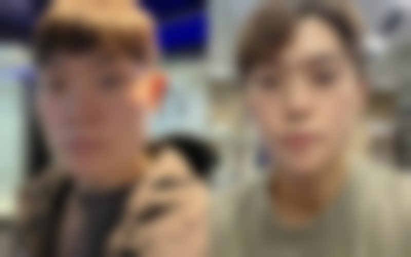 一、线提升隆鼻能保持多久的常见说法