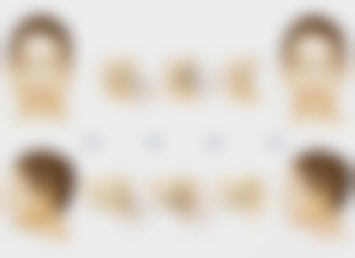 一、现在的技术割双眼皮风险概述