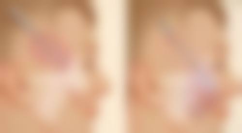 四、出现后遗症后该怎么办