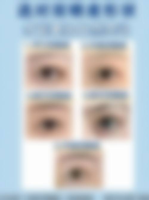 四、高州市人民医院整形美容科特色项目