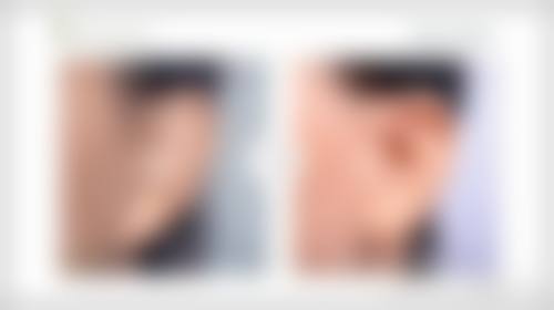 九、高州市人民医院整形美容科真实的患者评价