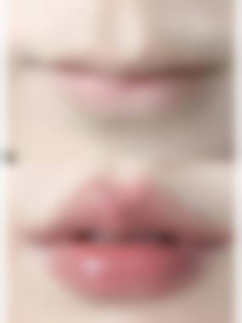 二、十堰维纳斯整形怎么样？