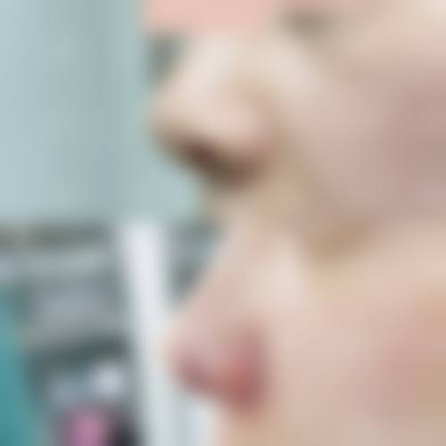 二、南通大学附属医院(烧伤整形科)怎么样？