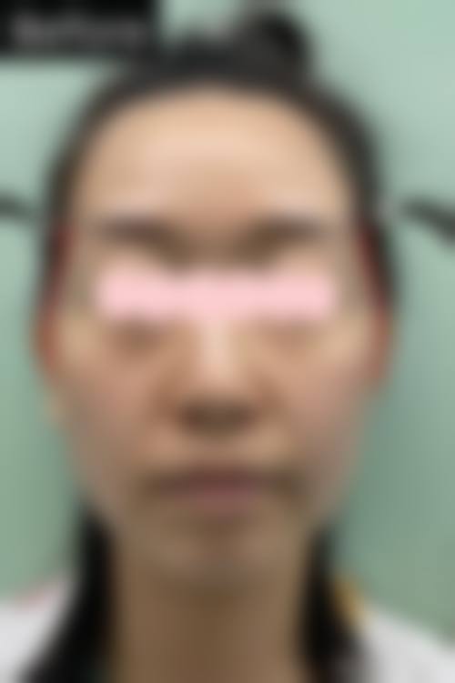 六、朝阳康韵整形医院价格表