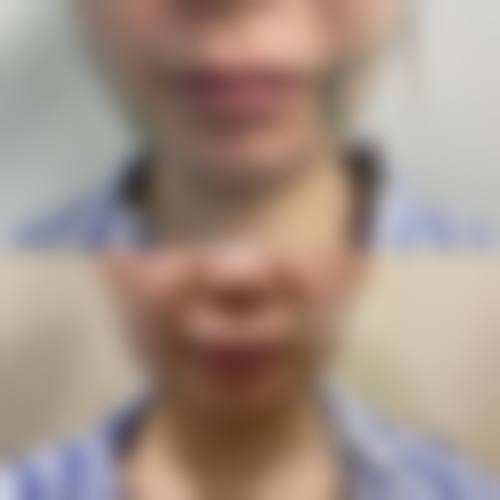 三、十堰维纳斯整形诊疗项目有哪些？