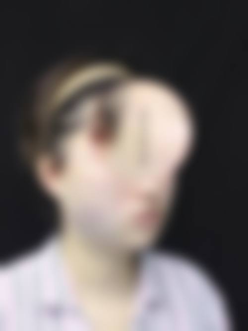 九、南通大学附属医院(烧伤整形科)真实的患者评价