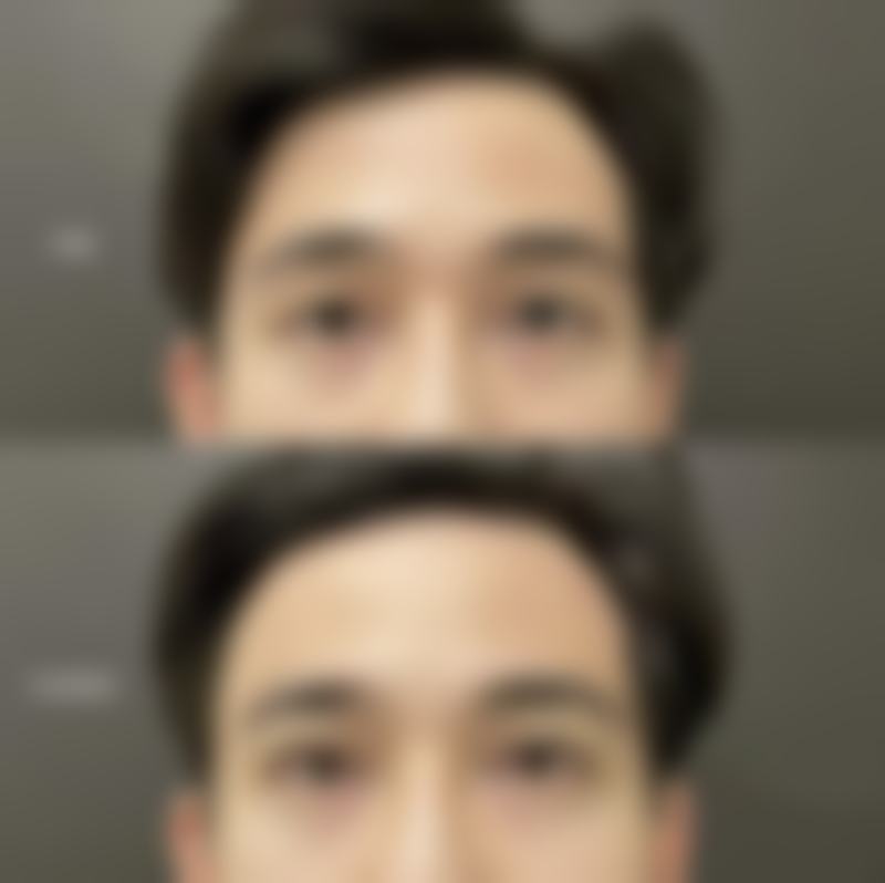 二、高州市人民医院整形美容科怎么样？