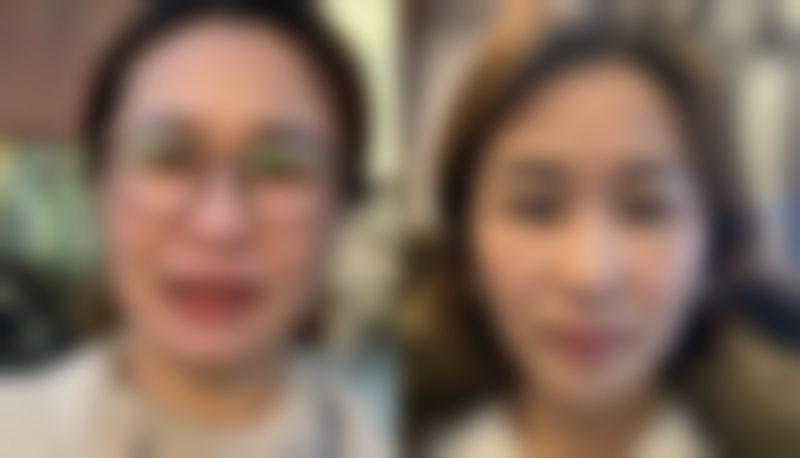 二、为什么会出现这些后遗症