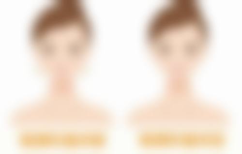 三、正规大型整形医院的优势