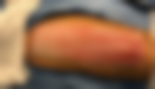 四、沈阳刘红医疗美容诊所特色项目