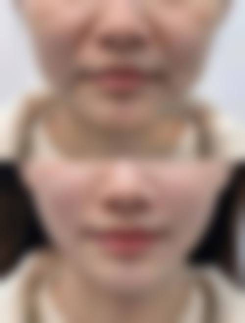 六、武汉洪山真程植发医院价格表