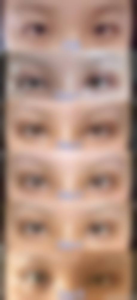 三、开封市眼病医院诊疗项目有哪些？