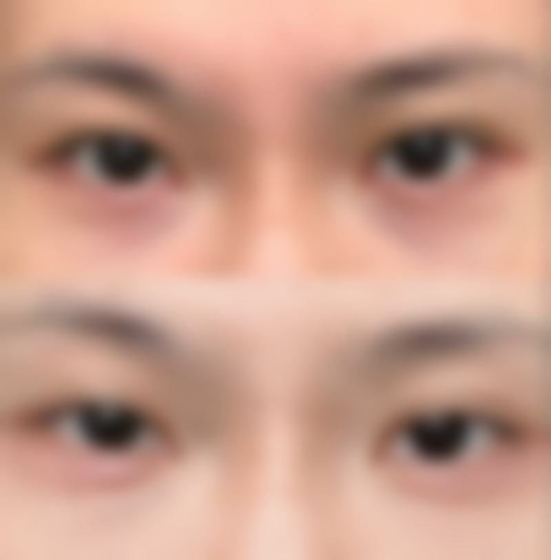 六、日常注意事项