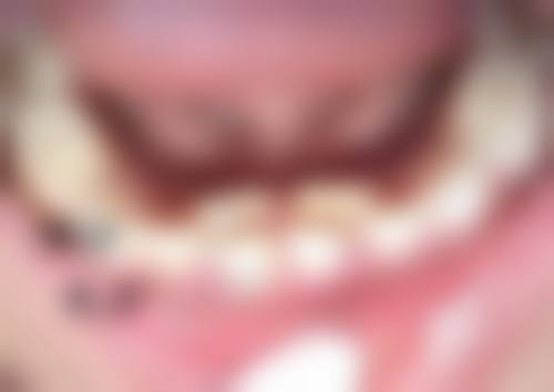 四、日常护理：淡化色素疤痕的基础