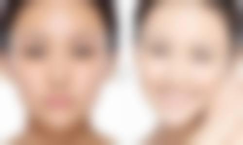 二、疤痕的治疗手段