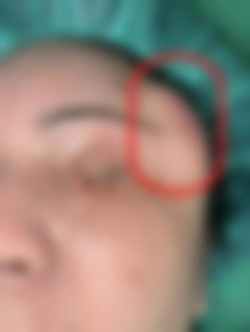 四、杭州临安君妍越妍医疗美容诊所特色项目