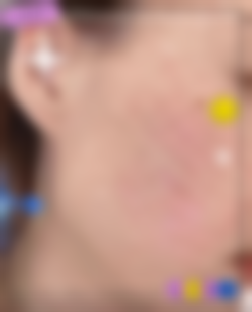 二、杭州临安君妍越妍医疗美容诊所怎么样？