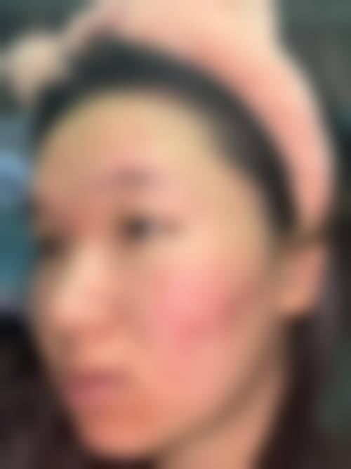 九、威海星范医疗美容真实的患者评价