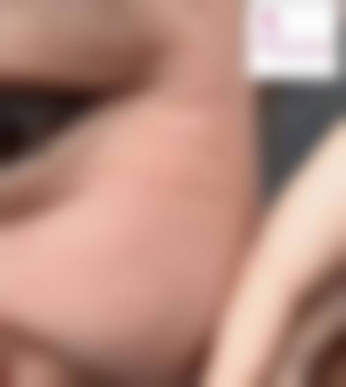 二、杭州赵正医疗美容诊所怎么样？