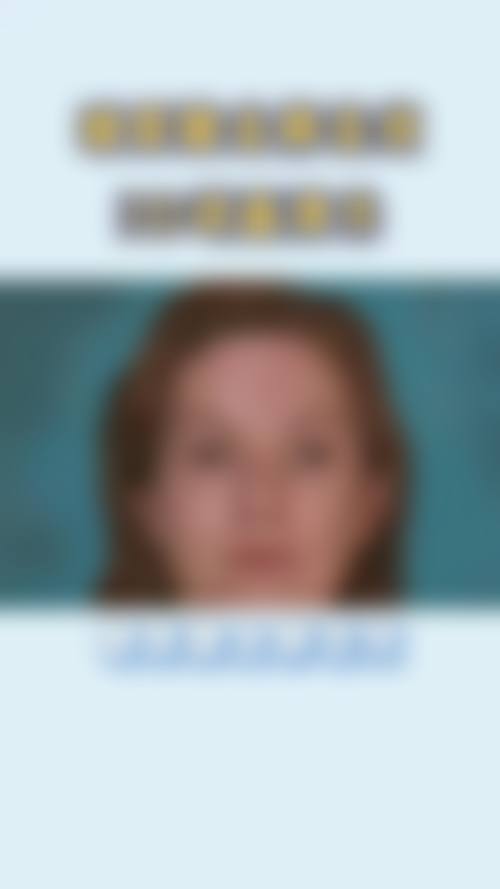 九、杭州赵正医疗美容诊所真实的患者评价