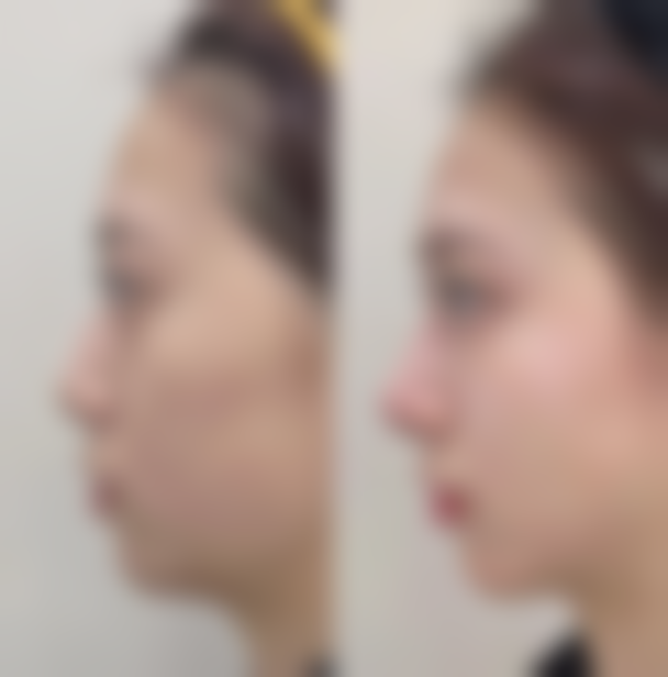 三、杜晓扬技术优势