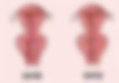 三、自体肋骨隆鼻实际情况中的不确定性