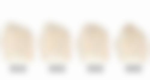 七、结论：自体肋骨隆鼻可以恒久的吗