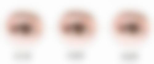 三、吉适——新兴进口瘦脸针品牌