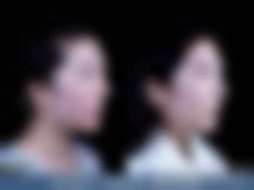 四、贵州贵阳浅蓝整形医院特色项目