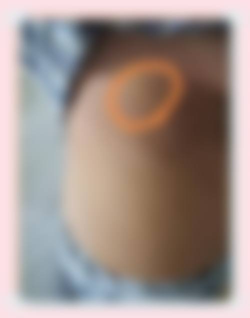 七、贵州贵阳浅蓝整形医院预约方式