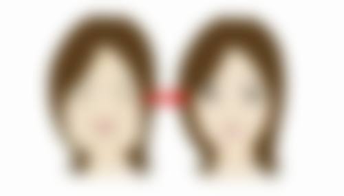 一、埋线双眼皮加宽的常见方法