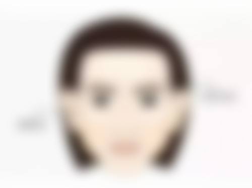 四、全切双眼皮宽修复窄的方式