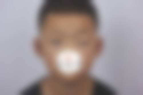 二、成都润美玉之光整形怎么样？