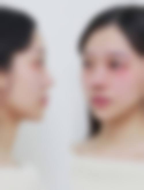 四、海口谷力医疗美容诊所特色项目