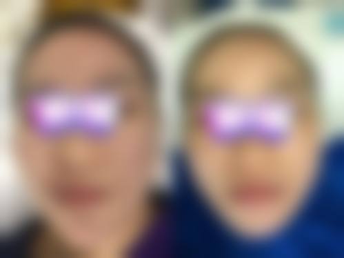 四、曹玉兰收费价格表