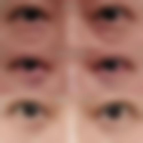 五、深圳北科美整形医院价格表