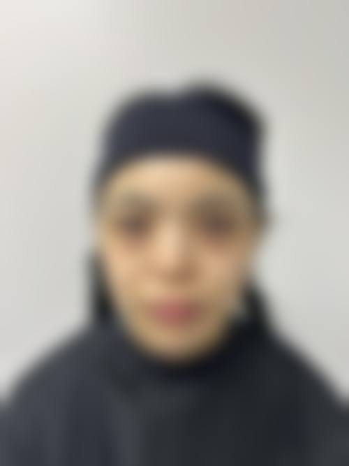 三、深圳北科美整形医院诊疗项目有哪些？