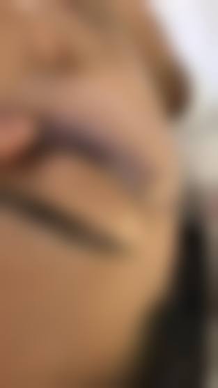 八、深圳北科美整形医院真实的患者评价