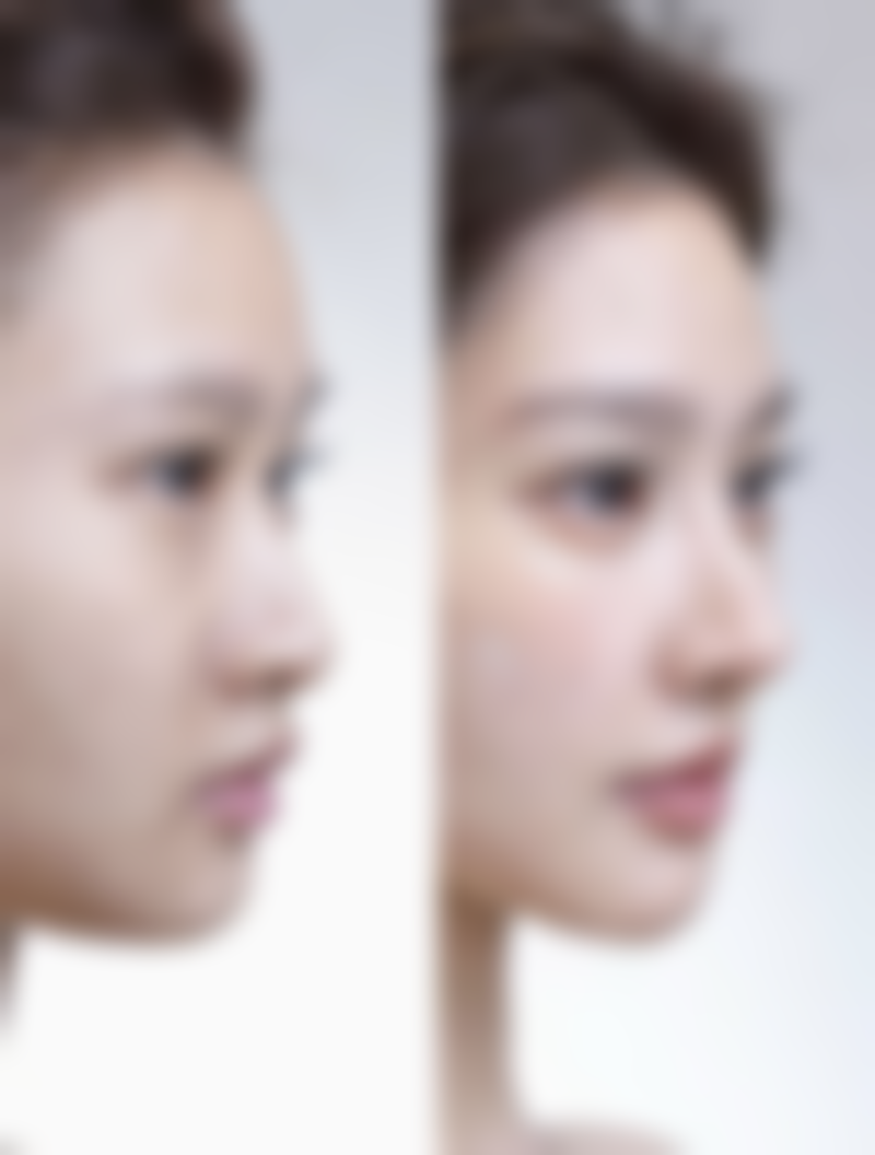 四、治疗后的皮肤护理