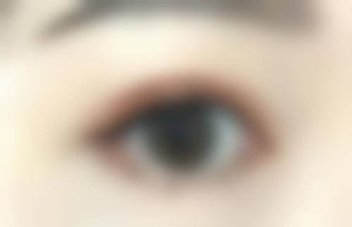 六、邹浅真实的患者评价