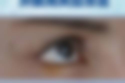 二、咬肌必须打瘦脸针吗：瘦脸针的原理和成效